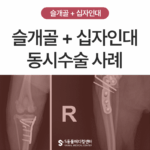 울산 강아지 십자인대 파열·슬개골 탈구 3기 동시 수술 케이스 | 무릎 관절 복합질환