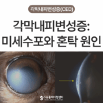 강아지 각막내피변성증(CED) | 백내장과 헷갈리기 쉬운 눈 혼탁 질환