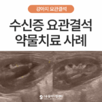 강아지 수신증 요관결석, 조기 발견과 약물치료 사례