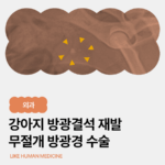 강아지 방광결석 재발, 무절개 방광경 수술로 제거한 사례