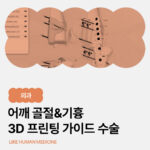 교통사고 후 앞다리를 들고 숨이 가쁘다면? 울산 강아지 어깨 골절과 기흉, 3D 프린팅 가이드 수술과 재활 치료 사례