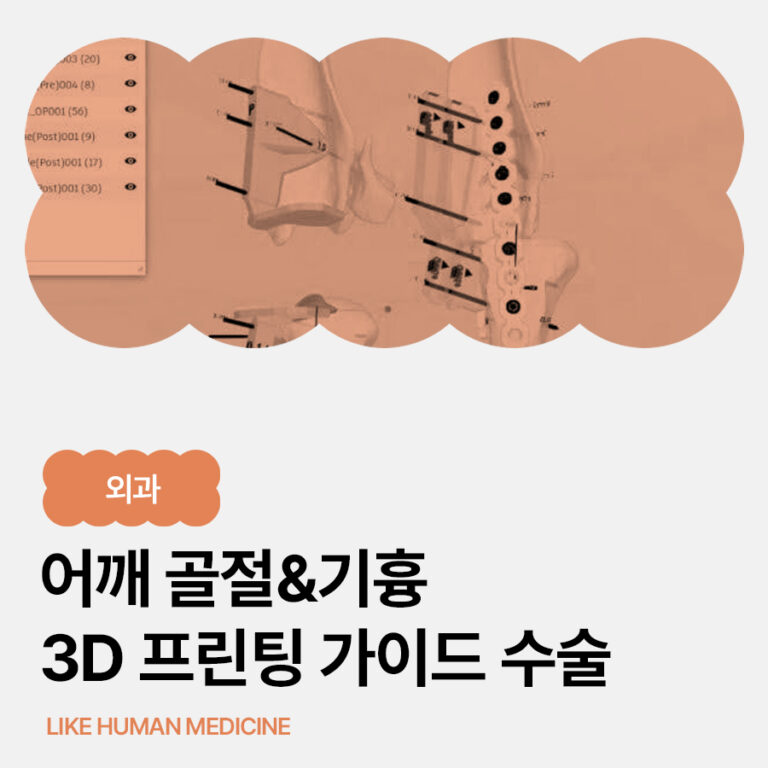교통사고 후 앞다리를 들고 숨이 가쁘다면? 울산 강아지 어깨 골절과 기흉, 3D 프린팅 가이드 수술과 재활 치료 사례