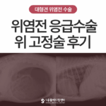 강아지 위 확장·염전증(GDV), 왜 응급일까요? 실제 수술 후기