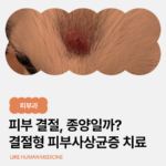 강아지 이마 피부 결절, 혹이 생겼을 때 확인해야 할 것들 | 결절형 피부사상균증 치료 사례