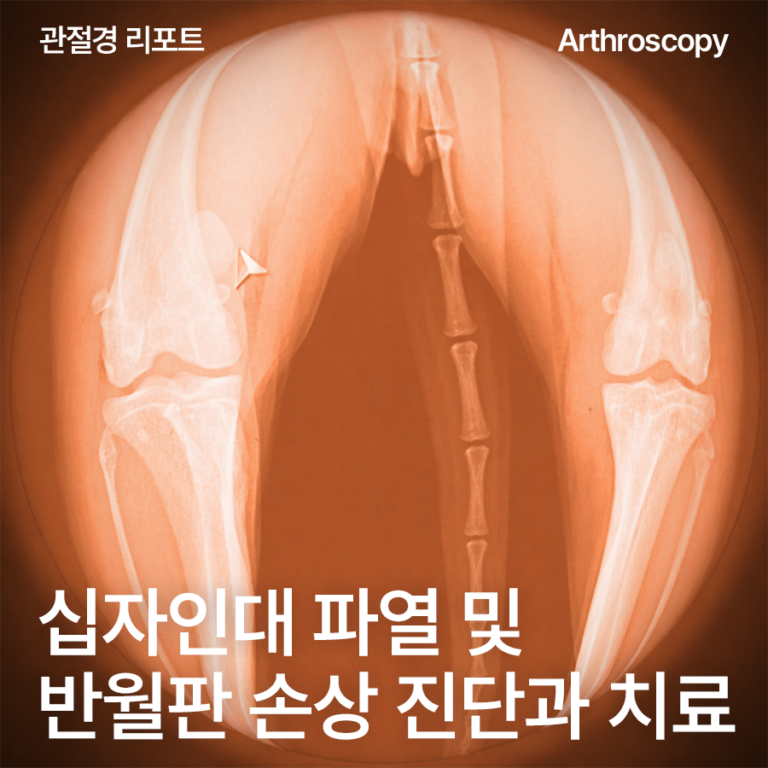 [울산 에스 관절경 리포트] 강아지 십자인대파열, TPLO 수술에 ‘관절경’까지 필요할까요? 리트리버 반월판 손상 동반 확인·치료·경과 후기