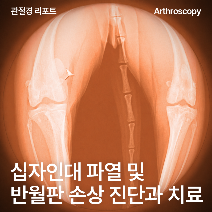[울산 에스 관절경 리포트] 강아지 십자인대파열, TPLO 수술에 ‘관절경’까지 필요할까요? 리트리버 반월판 손상 동반 확인·치료·경과 후기