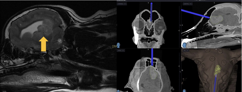 수술 중 브레인 네비게이션 화면