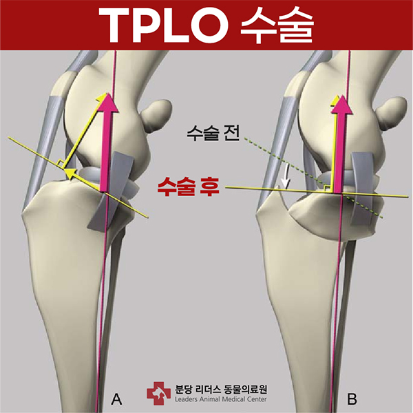TPLO 수술 이미지