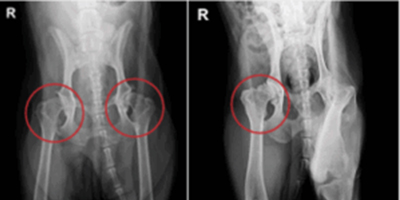 인공 고관절 치환술 수술 전