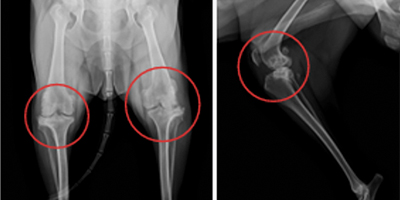 인공 무릎관절 치환술 수술 전