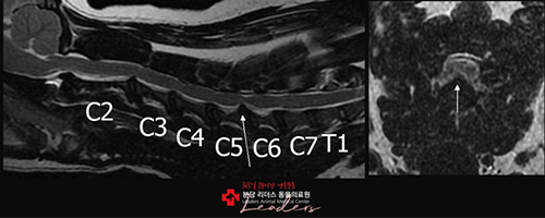 경추 디스크 정밀 진단 이미지