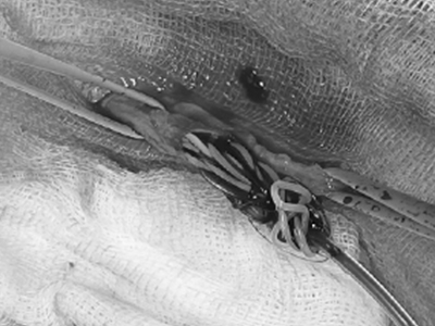 심장사상충 제거술 이미지 2