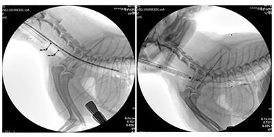 기도 스텐트 시술 이미지
