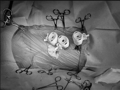 흉강경 장비 및 시술 장면 이미지