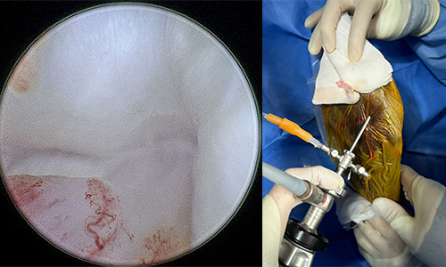 관절경 장비 및 시술 장면 이미지