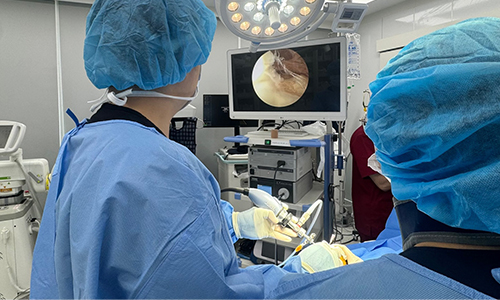 관절경 수술 장면 이미지