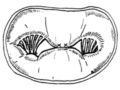 V-Clamp 모식도 이미지 1
