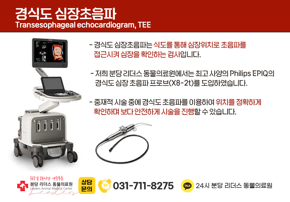 동맥관개존증(PDA) 모식도