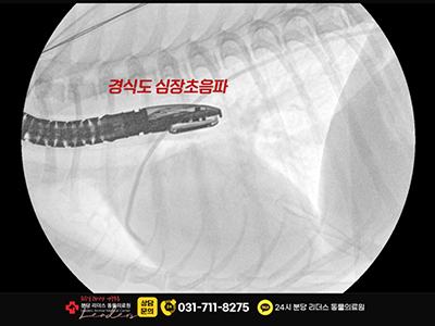 ACDO 기구 및 위치 설명 이미지