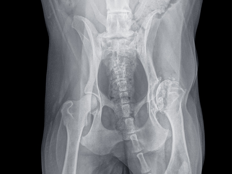 대퇴골두절제술 FHO 수술 이미지