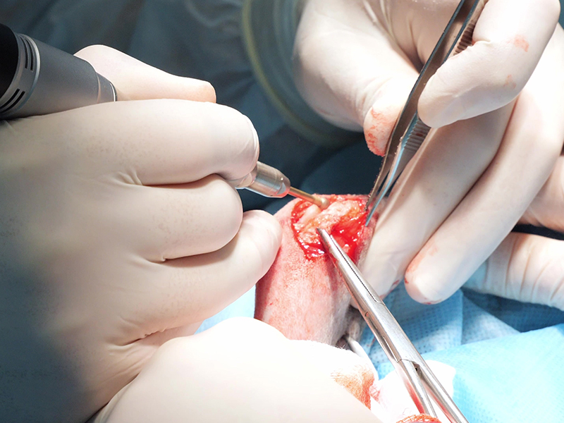 대퇴골두절제술 FHO 수술 이미지