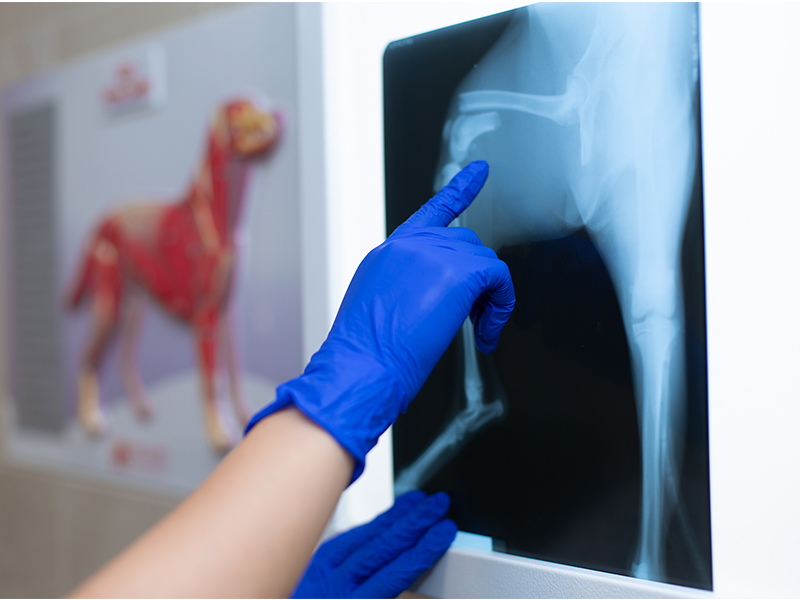 관절포함 골절수술