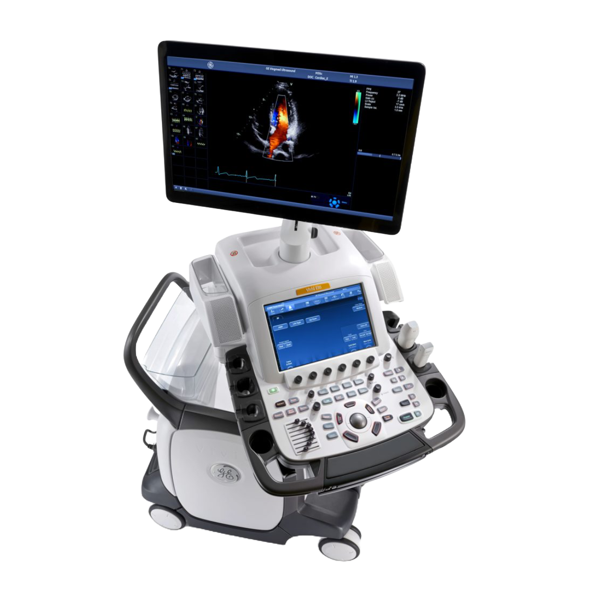 고해상도 심초음파