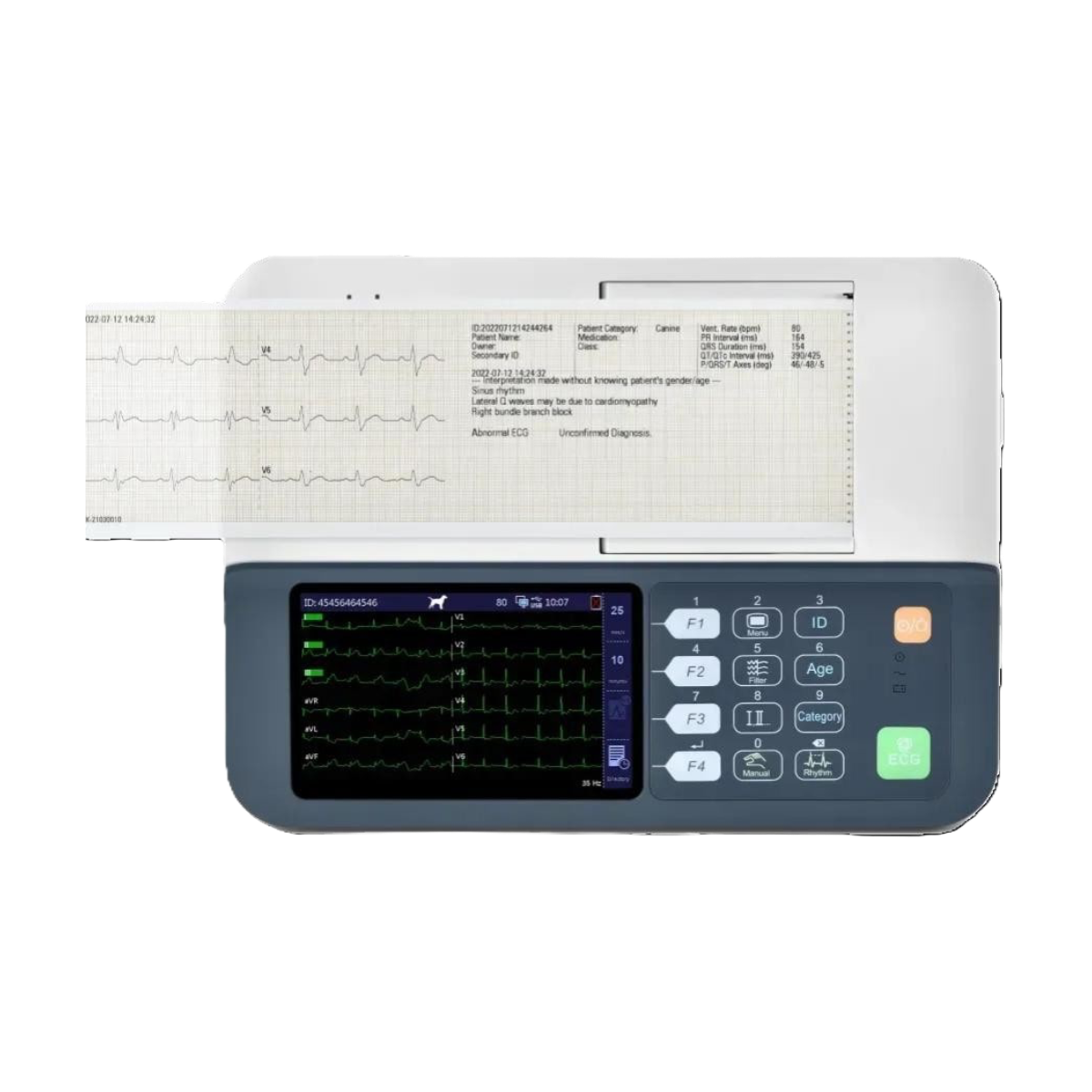 심전도 장비 이미지