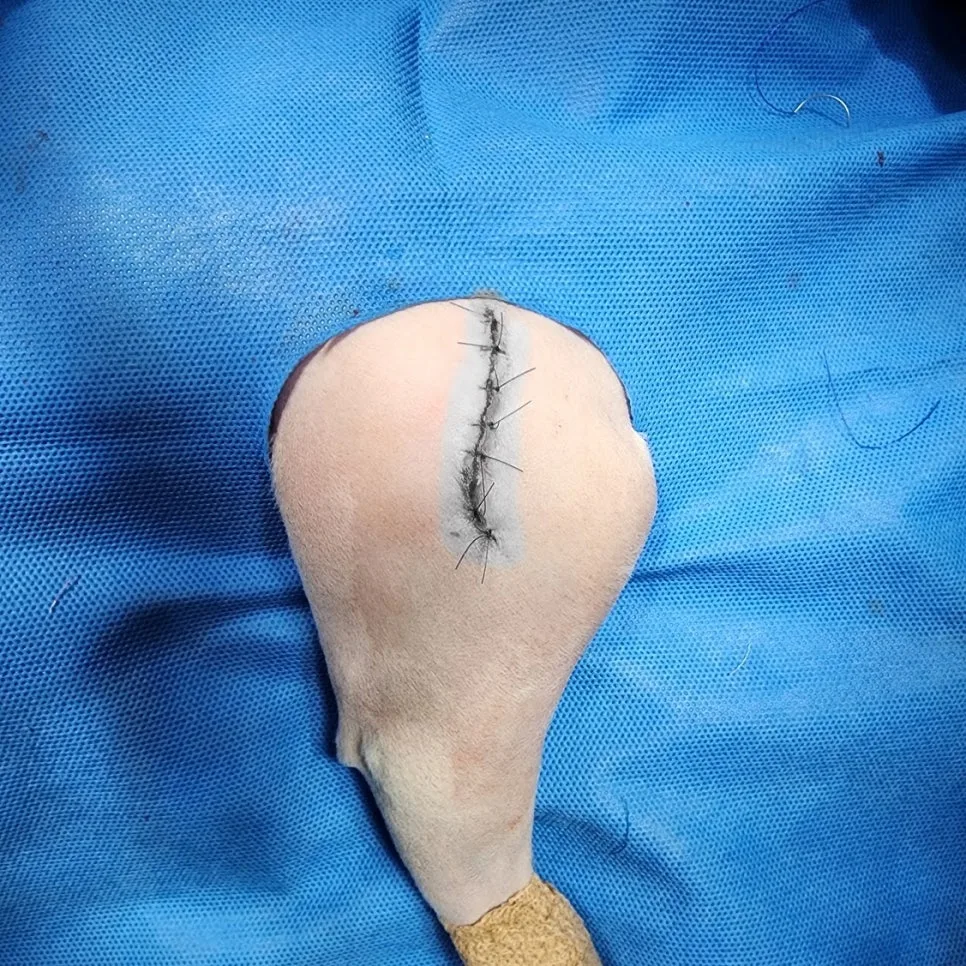 대퇴골두절제술 후 봉합한 수술 부위
