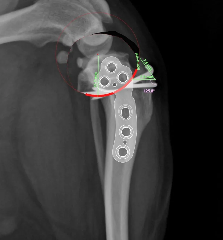 TPLO 수술 전 엑스레이로 세운 절골 각도 계획