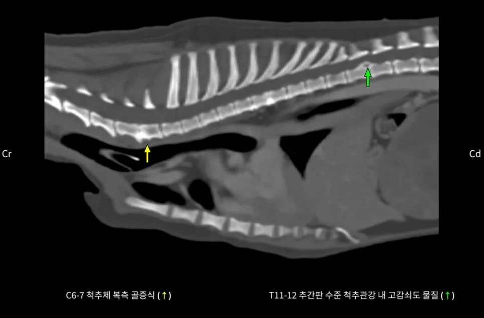 경추·흉추 디스크가 보이는 CT