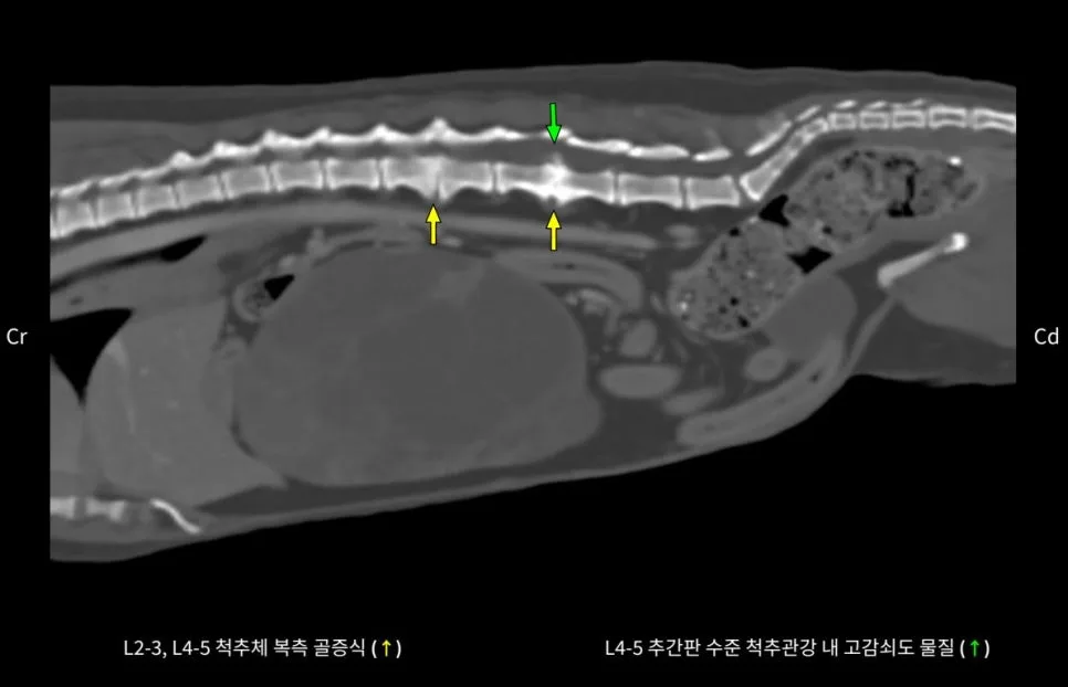 요추 디스크가 보이는 CT