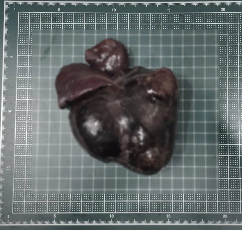 적출한 약 10cm 비장 종괴