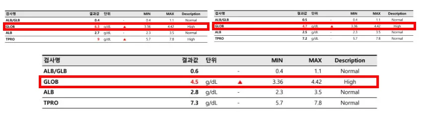 치료 중 글로불린 수치 변화